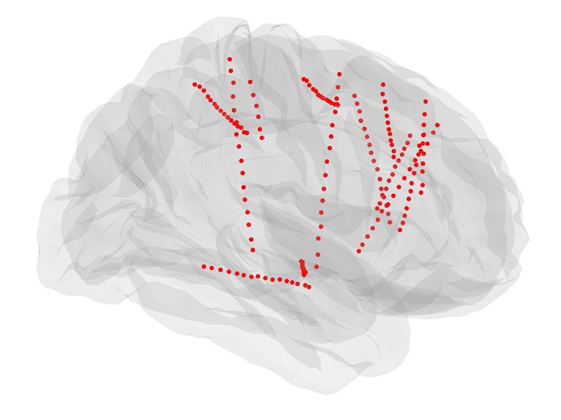 An illustration of the brain to demonstrate musical stimulation.
